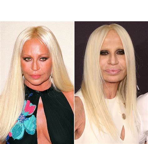 donatella versace weight loss|donatella versace personal life.